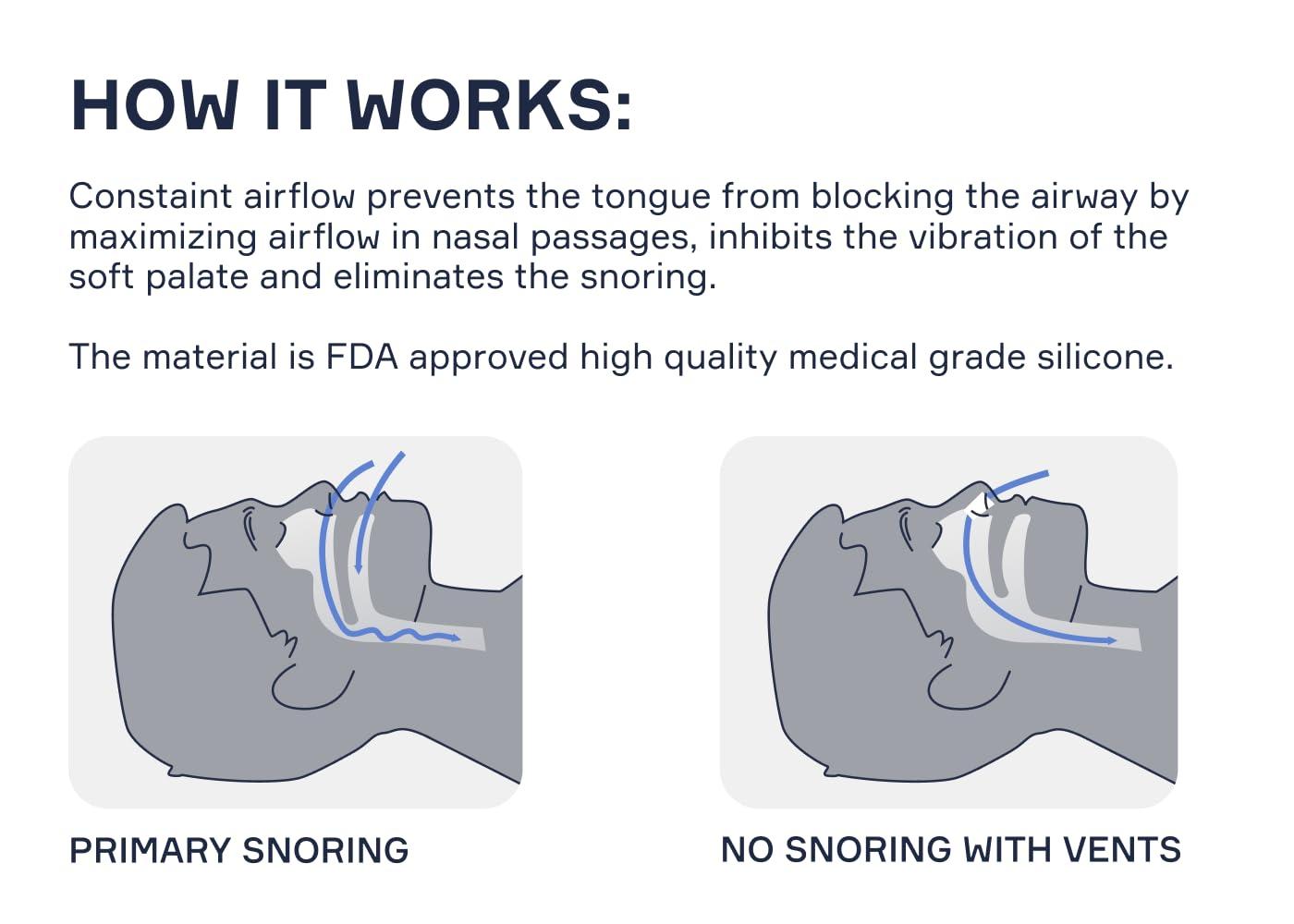 Snore Bastion Anti Snoring Devices by Snore Bastion - All ONE Size (L) Large - Nasal Dilator - Snoring Nose Vents - Snoring Solution - Medical Grade Silicone Snore Stopper - Stop Snoring