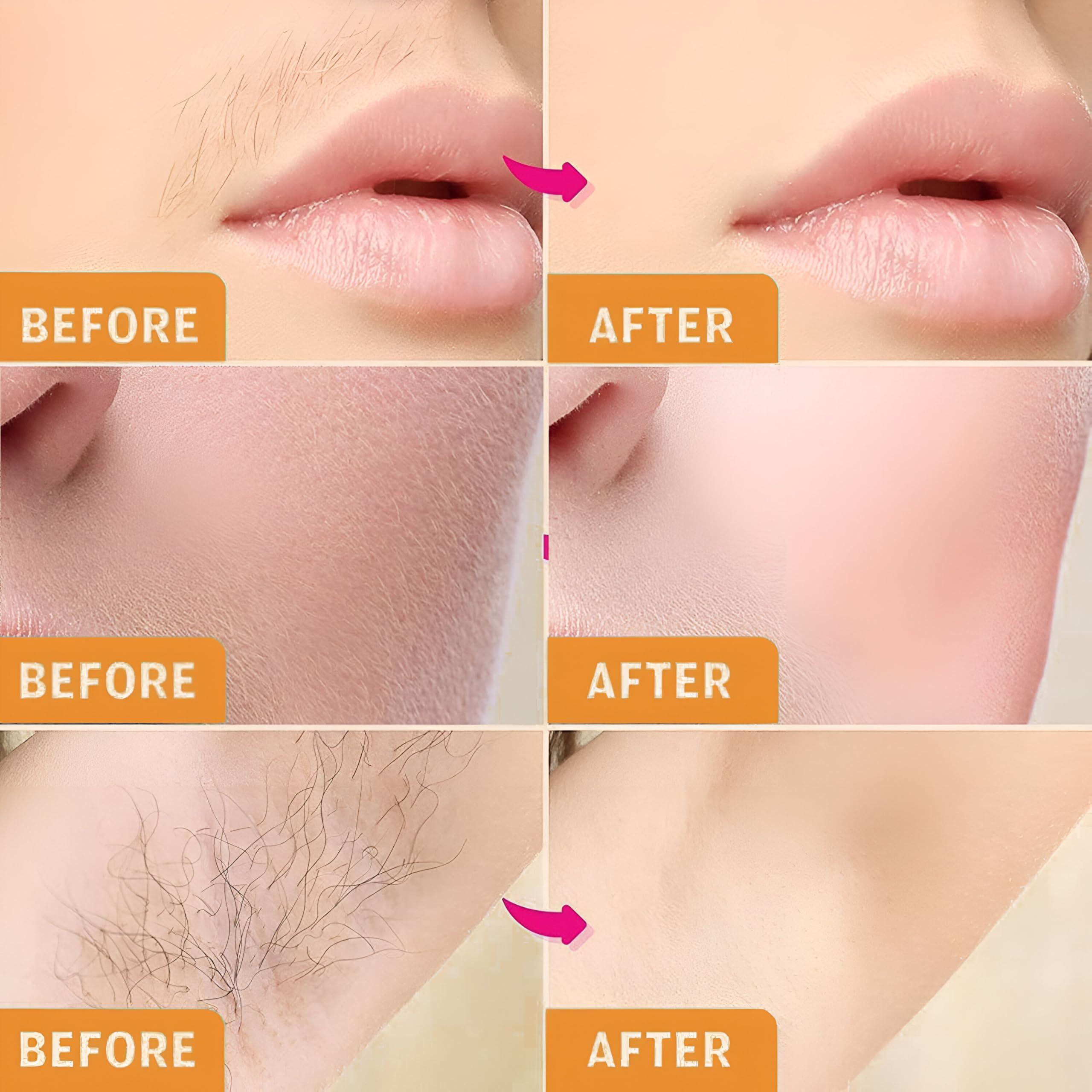 KNYUC MART KNYUC MART Hair Removal Waxing Strips for Eyebrows Face Upper Lip Chin Facial Wax Strips for For Legs,underarms (20 Strips +2 pcs finish wipes) (CHAMOMILE)