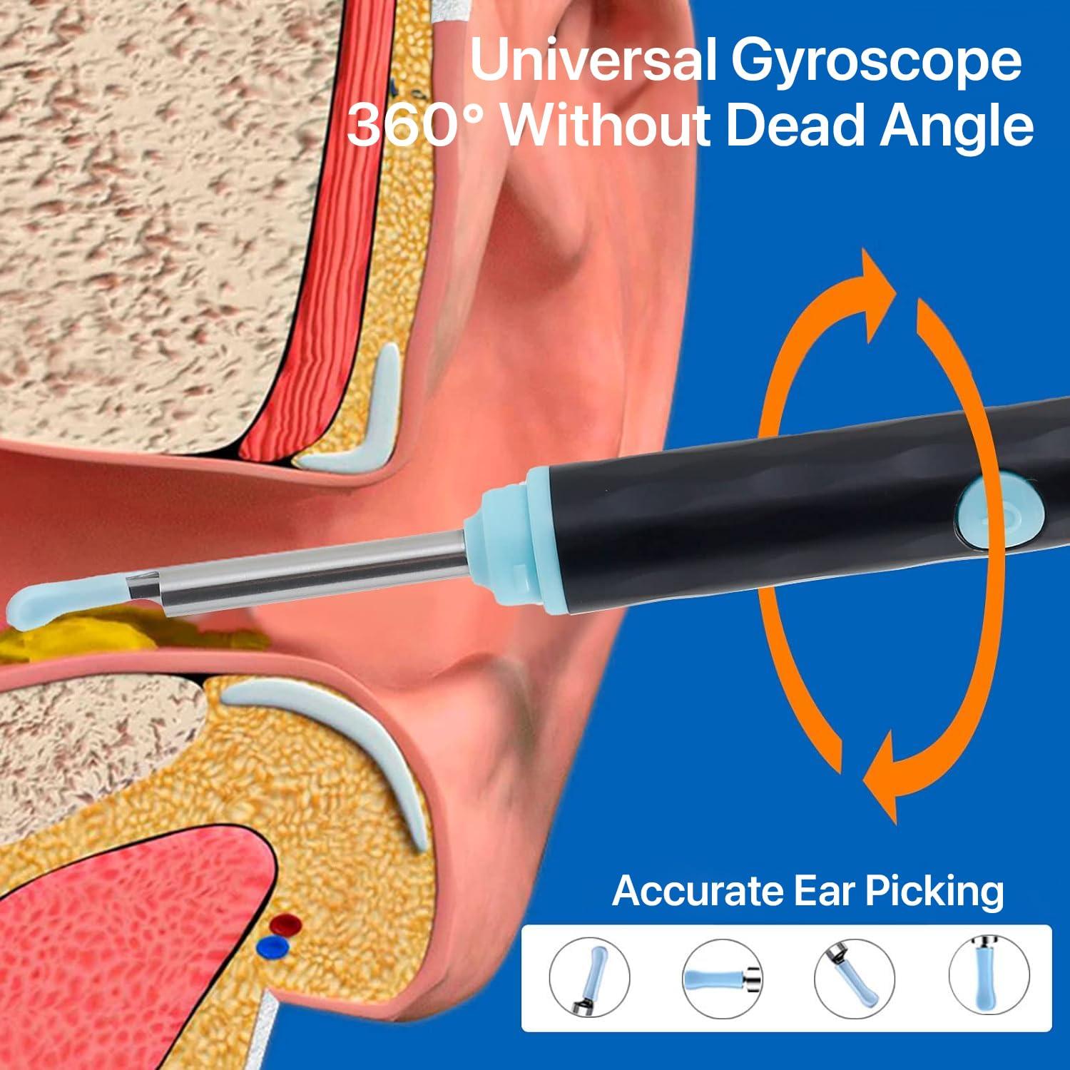 DR VAKU Dr Vaku Earocam Earwax Removal Tool Kit with HD Camera Wifi Connection & 6 LED Lights Endoscope Tool Ear Cleaner for iOS & Android + 10 Silicone Tips Free