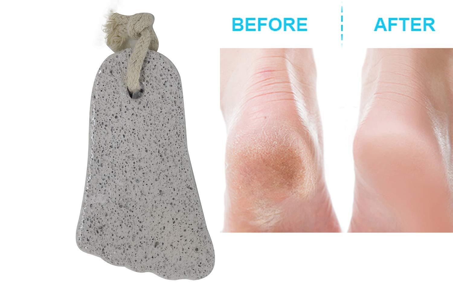 BAAL Baal Pumice Stone For Feet Pedicure Tools Hard Skin Callus Remover For Feet Pack Of 1