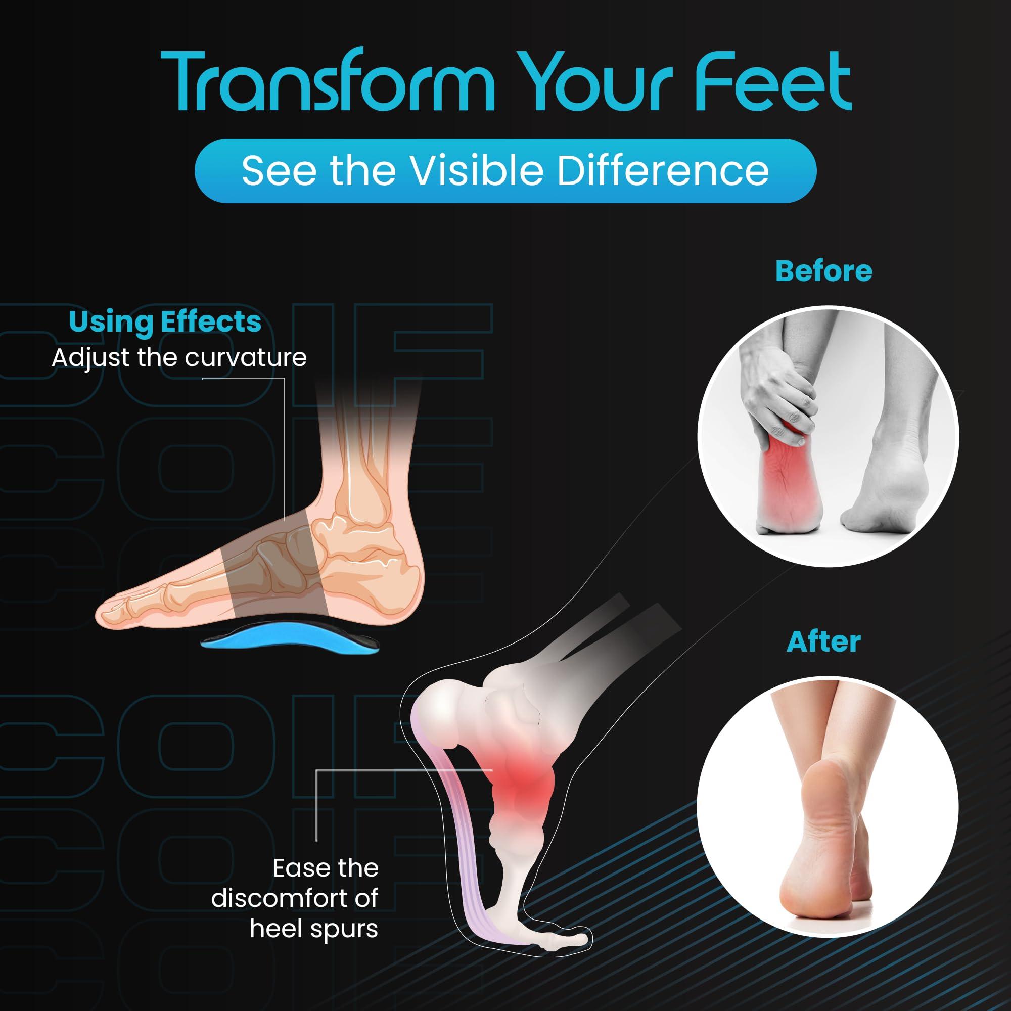 COIF COIF Foot Care Plantar Arch Support for Men & Women for Pain Relief of Plantar Fasciitis, Flat & Fallen Arches, High Arch, Heel Spurs, Flat Feet