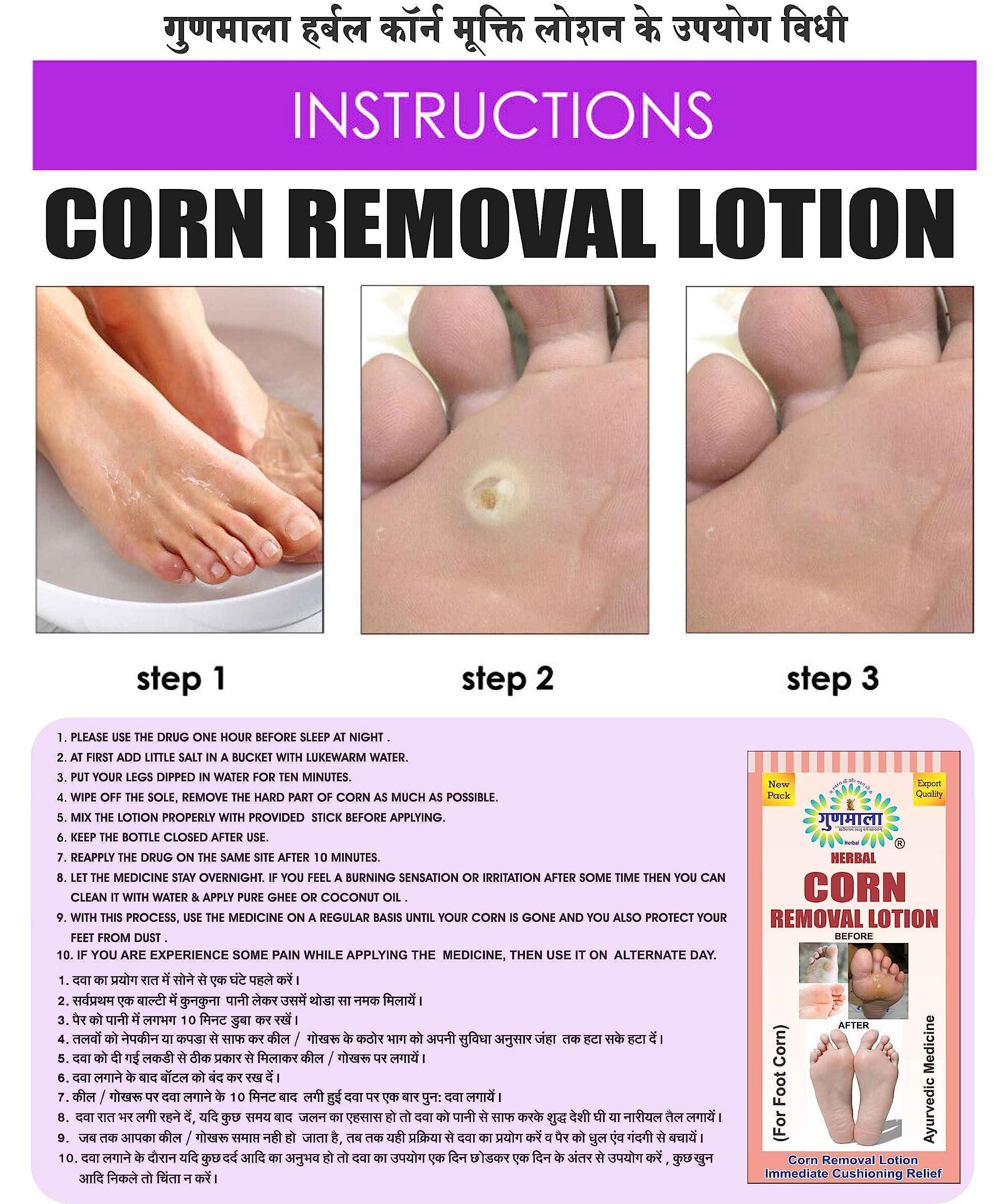 GUNMALA Herbal Foot Corn Lotion, For Remove Feet Fast And Relives From Pain & Pinch In Walking Best For Feet Infections, 5 Ml. Bottel Pack,Qty.-Pack Of 2