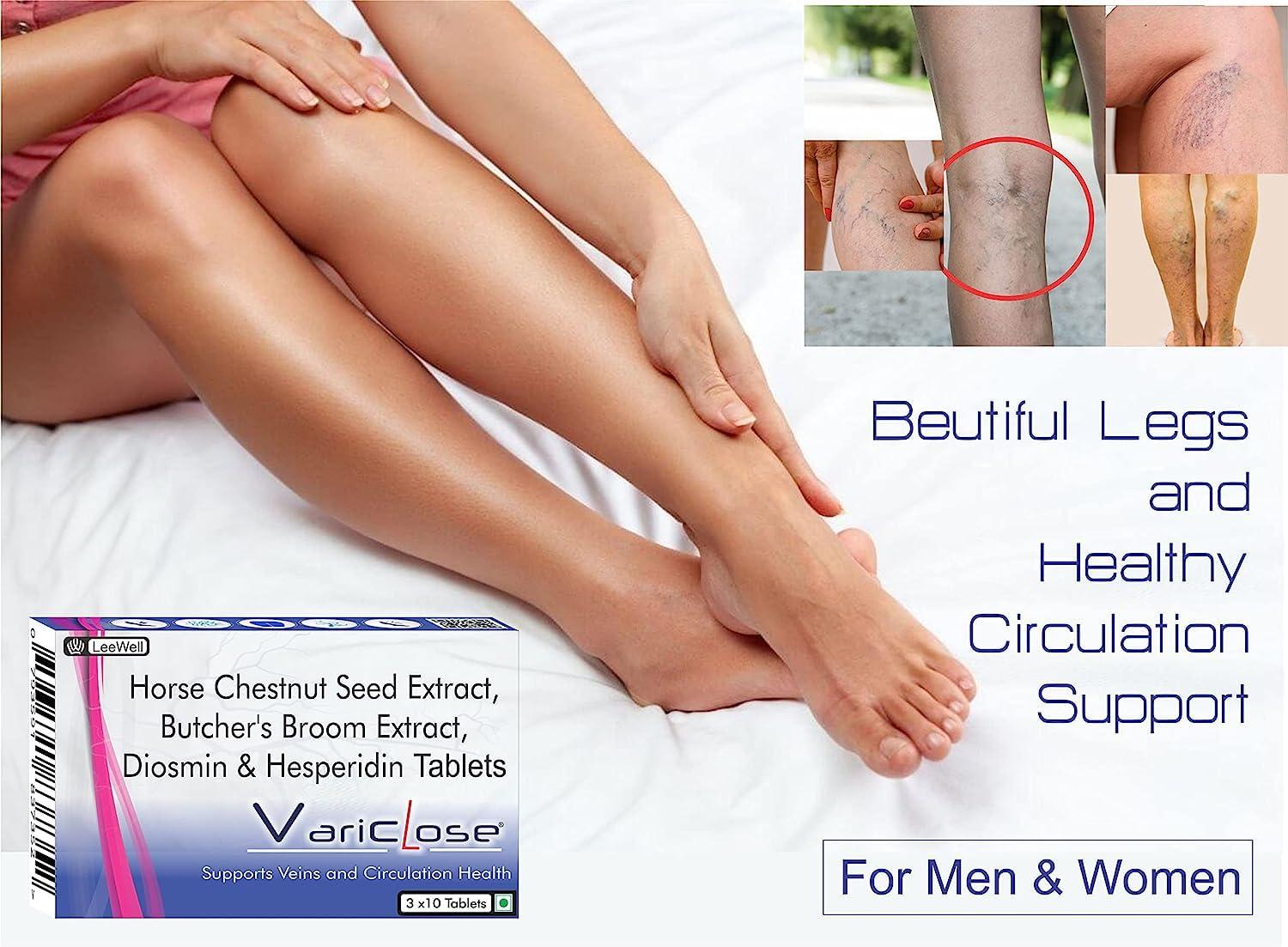 VARICLOSE Variclose Support Varicose Veins, Spider veins | Diosmin, Hesperidin, Horse Chestnut extract (Aescin), Butchers broom extract (Ruscogenins) | Plant based Foot, Legs Vascular Micro Circulation Support Supplement -60 Tablets