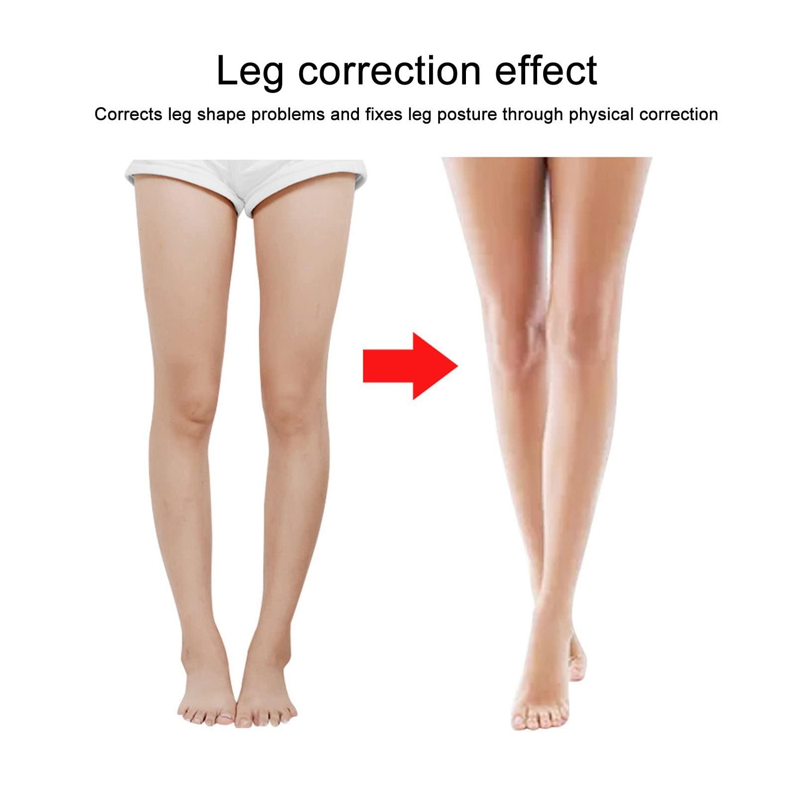 Generic NEE Leg Correction Belt Soft Elastic Correct Leg Tape 3 Pcs. Black for O Type Legs L