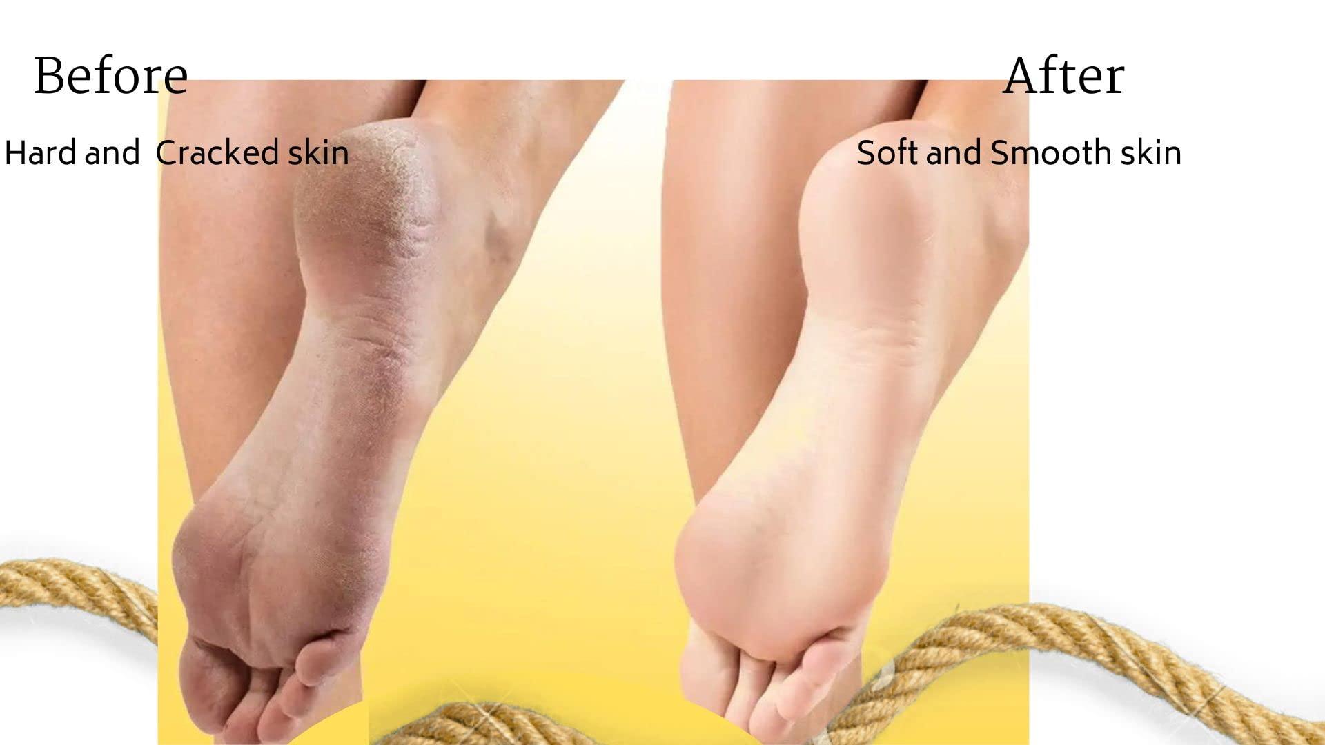 Generic Trust Pharma Padhari Foot And Palm Crack Healing Cream 20 gm * 3 pcs pack of 1