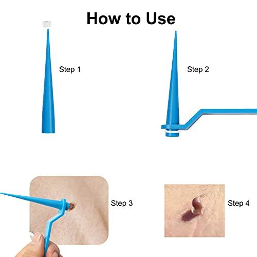 QUKAN QUKAN 2 in 1 Skin Tag Remover Set Skin Tag Removal Kit with Rubber Bands Rings for Removing Small to Medium (2mm to 8mm) Sized Skin Tags Painlessly