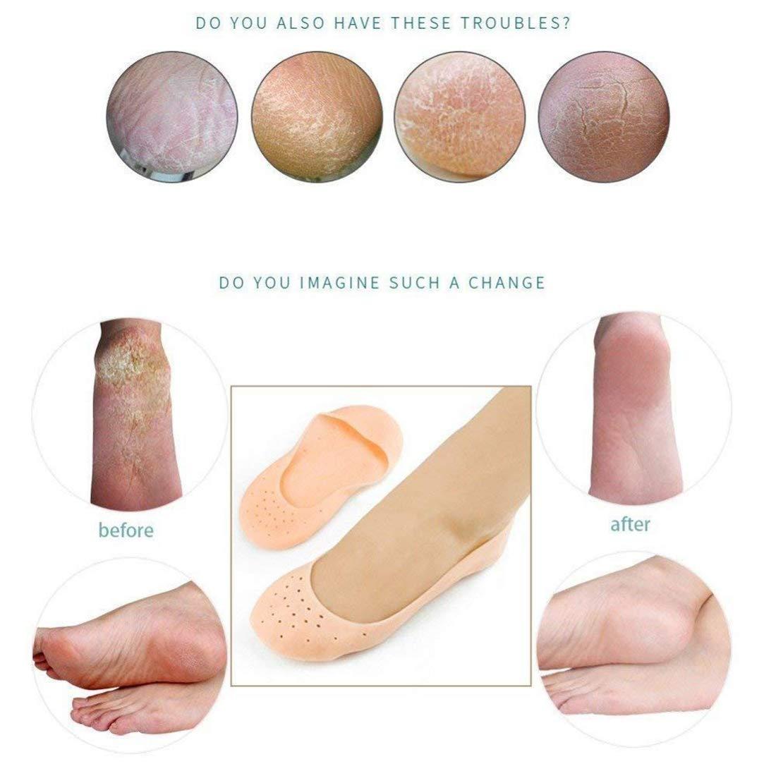 adbeni Adbeni Heel Anti-Crack Sets For Foot Care