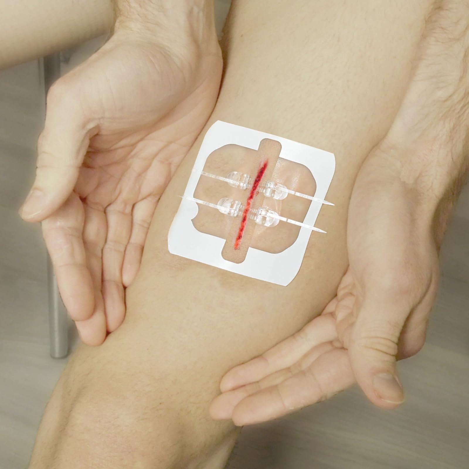 Mediss Mediss Emergency Wound Closures Band-Aid Adhesive Bandages, Zip Stitch Stickers For Camping, Survival & Household Gear, 2 Pcs/Box