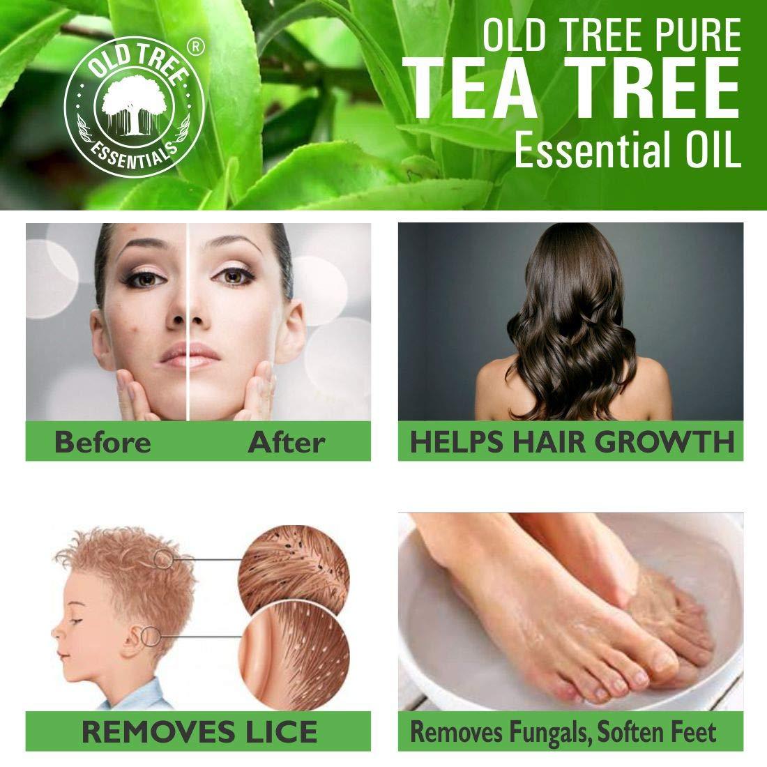 Old Tree Old Tree Pure & Natural Tea Tree Essential Oil (15ml) - for Skin, Diffusers, Hair, Body, Acne, Nail care - Undiluted Essential Oil with Dropper for Aroma Therapy and Stress Relief