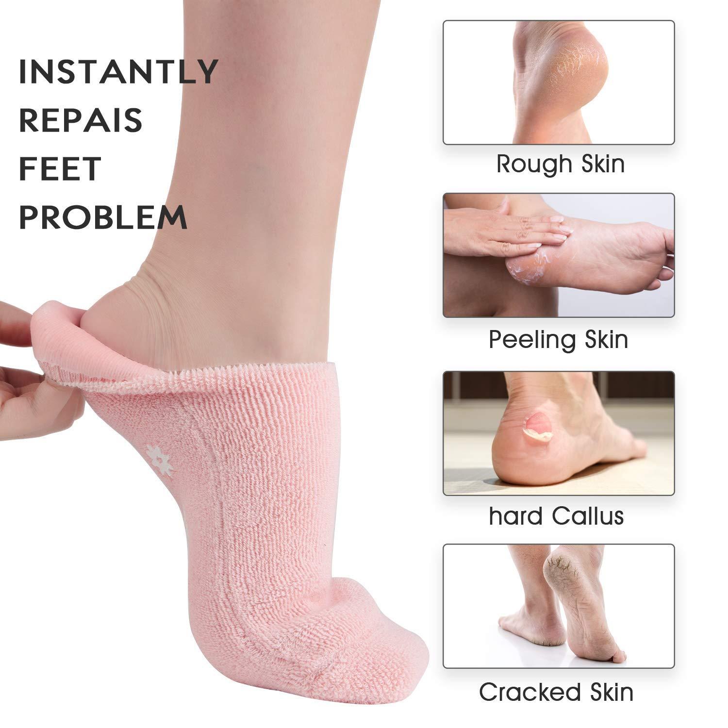 Nearstop Nearstop™ Women Men Moisturizing Gel Socks for Soften Cracked Non-Skid Soft Cotton Gripper Socks Spa Moisturizing Socks Feet Care Treatment (Pink)