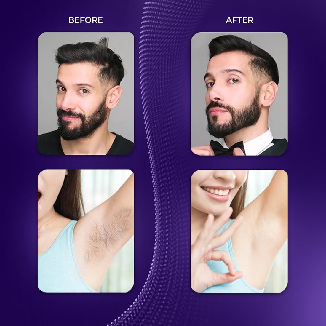 IKONIC Ikonic Unisex 3-in-1 Personal Body Groomer with Stainless Steel Blades, Fully Charges in 5 hours with 90 Mins Runtime. 500Mah Battrey, LED Light Indicator, Waterproof, Unisex Hair Trimmer for Sensitive Areas, Nose & Ear, Coral