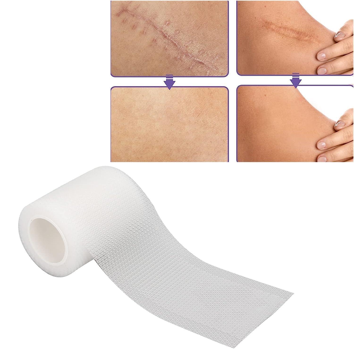 LUPINEZ LUPINEZ Transparent Medical Silicone Gel Tape for Scar Removal,Scar Transparent for Surgical Scar, Silicone Scar Sheets, Silicon gel sheets for Scars
