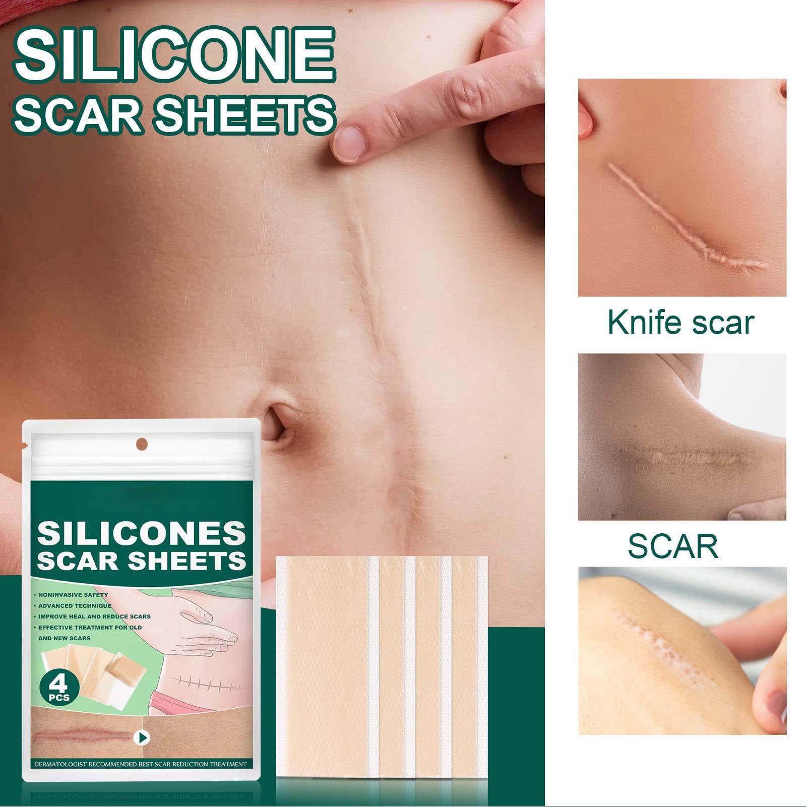 Folanda 4 Pcs Silicone Scar Sheets, Ultra Thin Breathable Silicone Gel Scar Tape, Soften and Flattens Scar Removal Strips for C-Section, Surgery, Burn and More, Skin Scar Concealing Tape