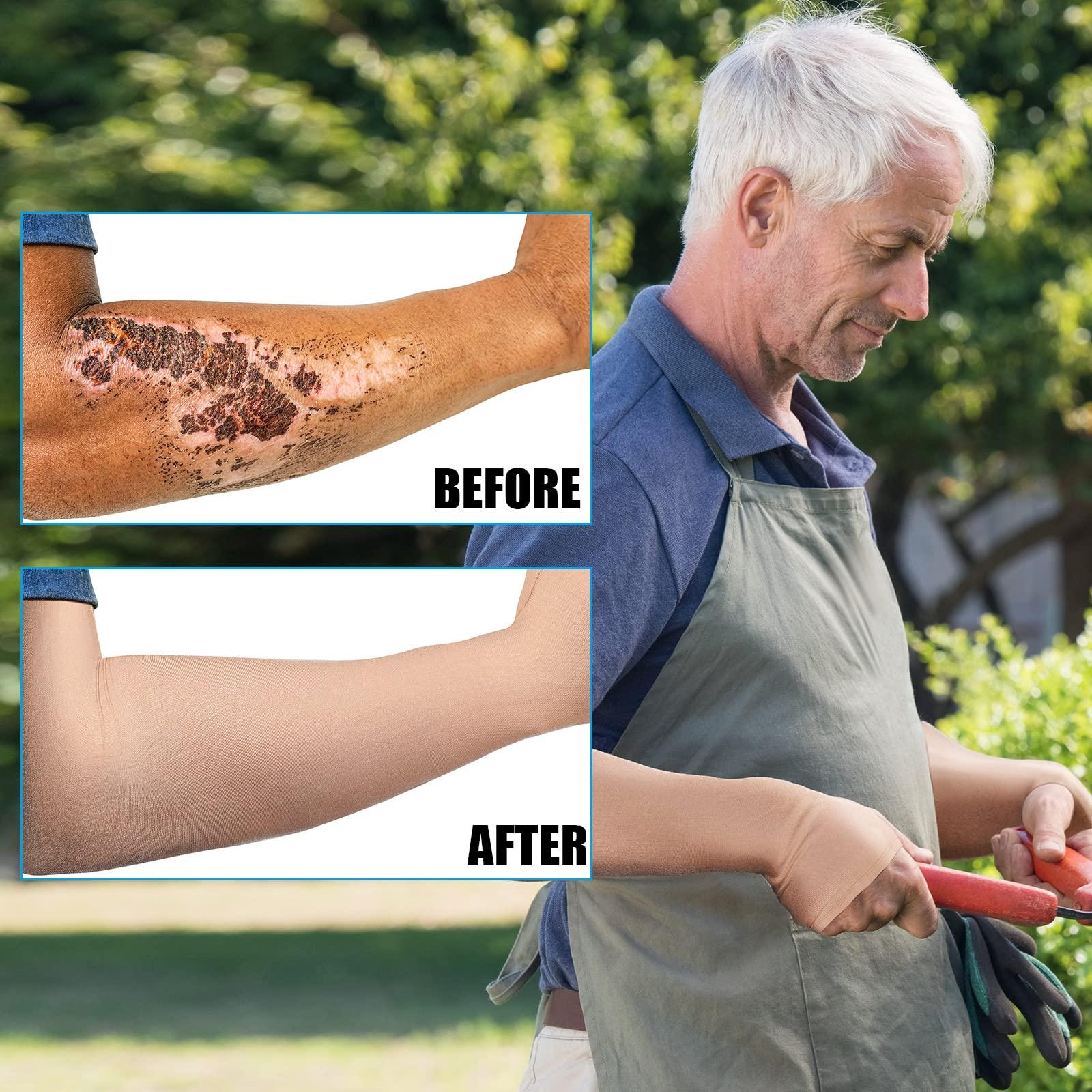 Coume Coume 2 Pairs Arm Skin Protection Sleeves Arm Protectors for Thin Skin and Bruising Compression Sleeves Washable Arm Sleeves(Elegant Style,Large), Nude