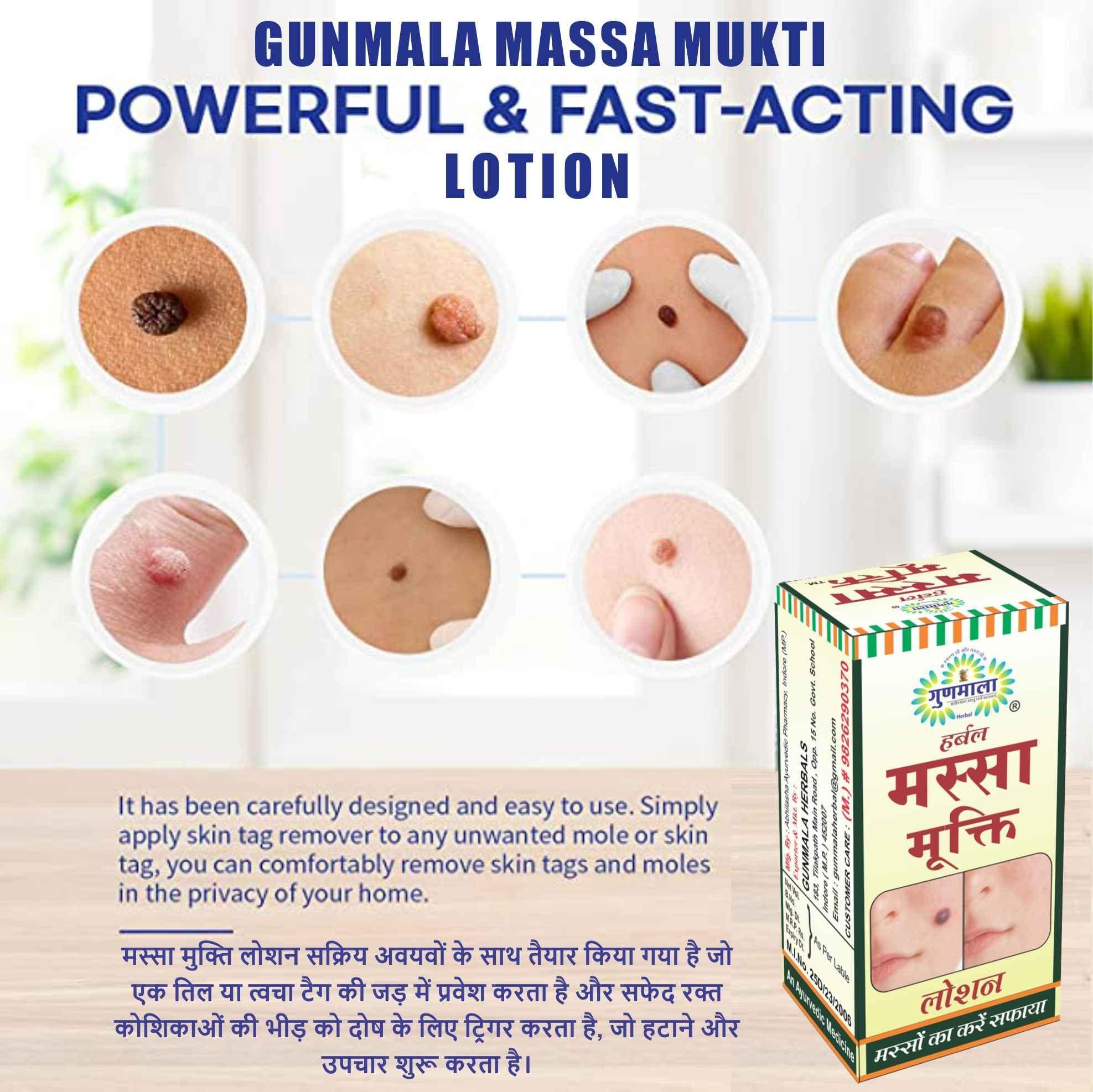 Gunmala Herbals Gunmala Herbal Massa Mukti Lotion - 20 Ml. (Ayurvedic Skin Tag Remover)