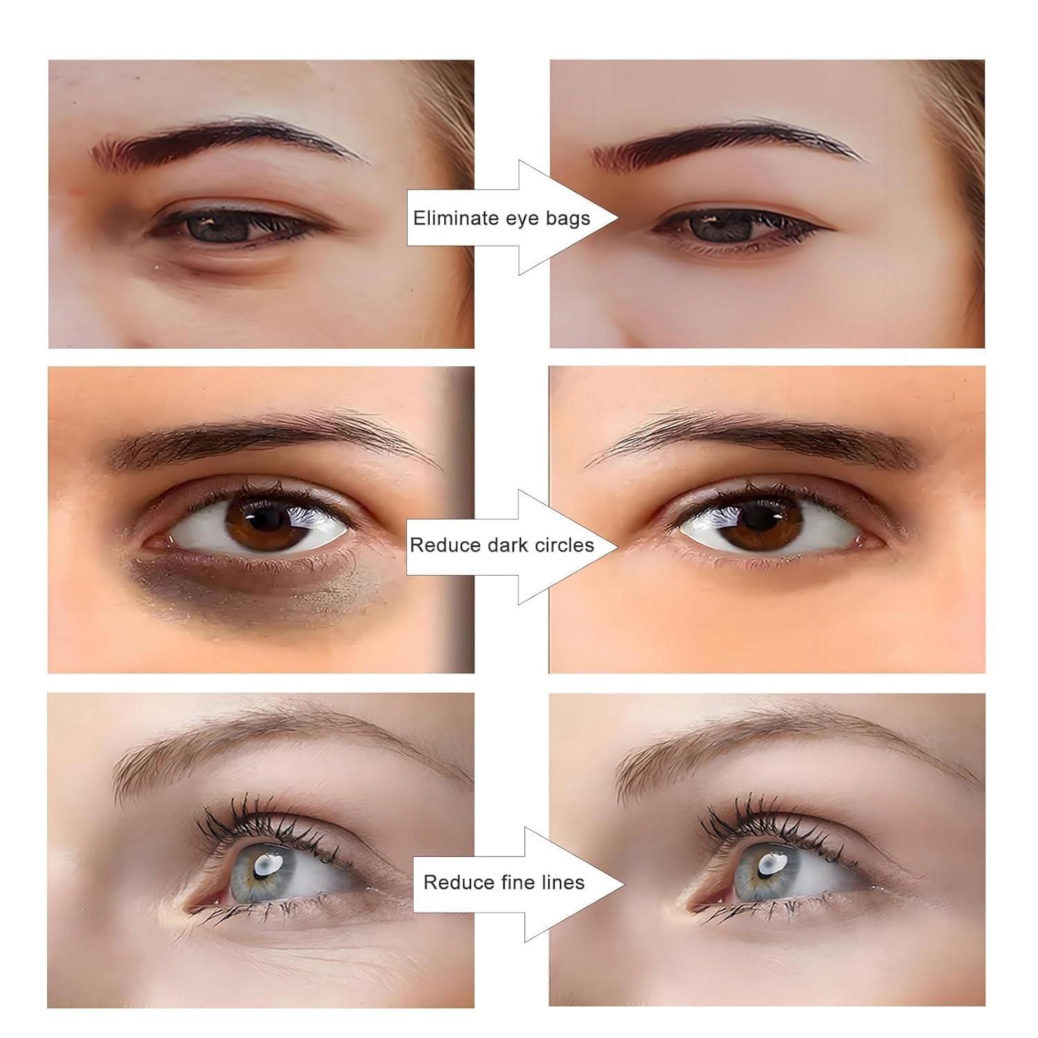 SEAHELTON SEAHELTON Revital Eyes Red Light Glasses, Revitaleye Therapy Advanced Under-Eye Renewal Therapy,Revitaleyes Microcurrent Eye Beauty Device, Diminishes Dark Circles and Wrinkles, Universal size, White