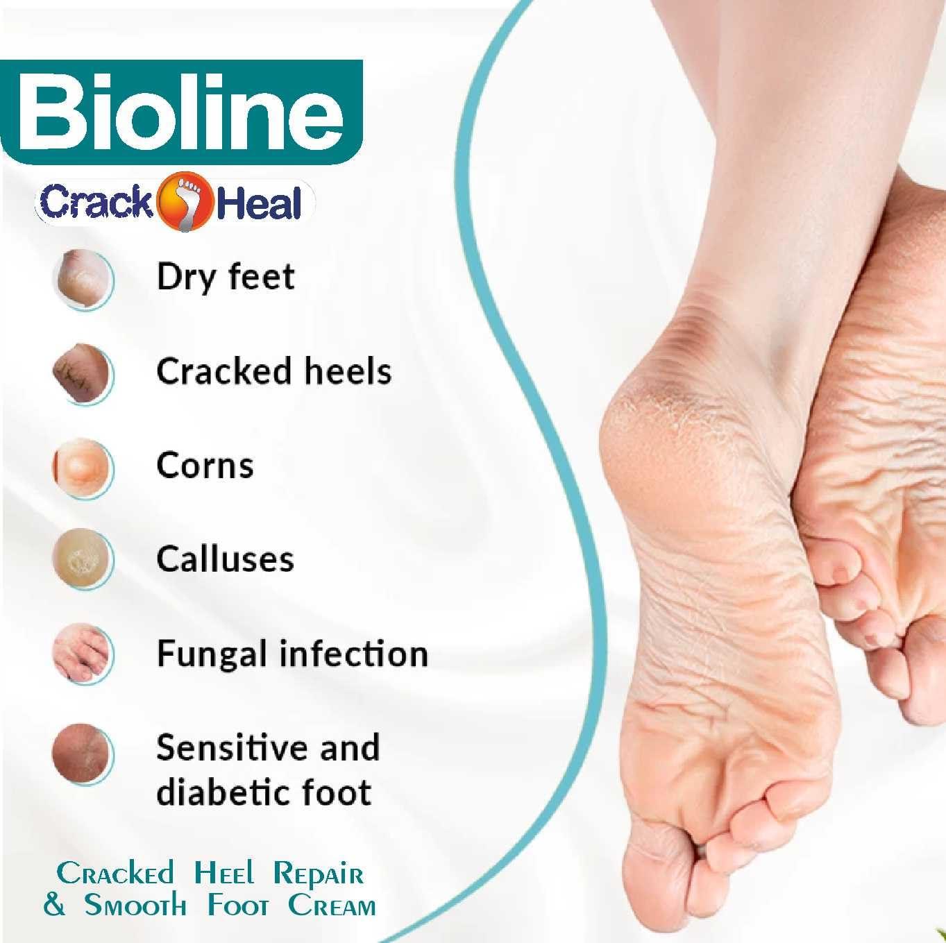 BIOLINE BIOLINE Crack Heal Foot Cream For Dry Skin & Cracked Heels - 50 g Each (Pack of 6)