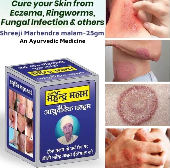 RUDRAMANI RUDRAMANI Shreeji Marhendra Anti fungal Malam - for Ringworm, itching, Eczema,Burn Mark, Foot Care (50G)