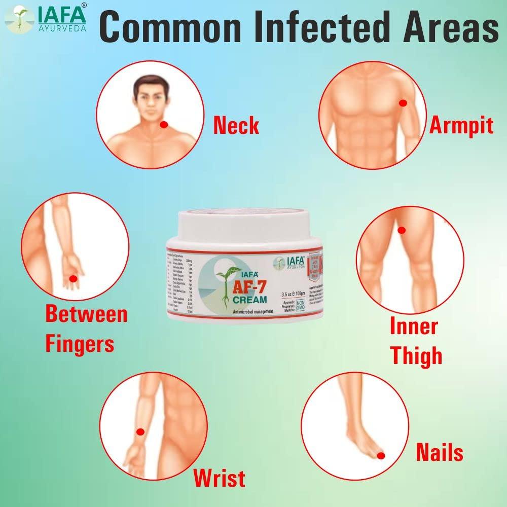 IAFA IAFA Ayurvedic AF-7 Cream 50gms- Natural cure for Fungal infections | Fast Relief from Ringworm, Skin infections, Jock itch, Anti chafing, Intimate area itching, Skin rashes, Skin allergy | Anti Itching | Irritation | For All skin problems | Daad khu