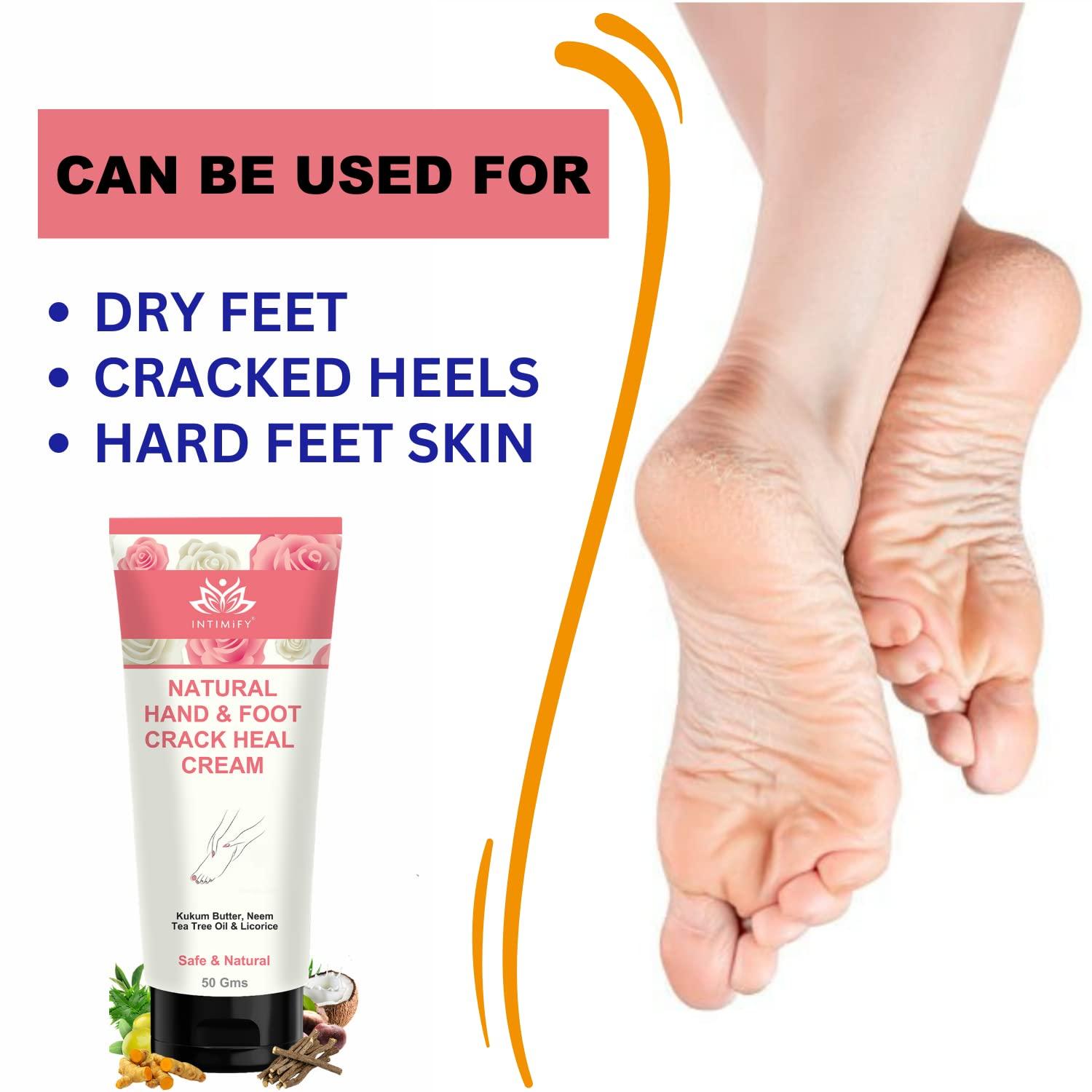 INTIMIFY INTIMIFY Foot Cream for Cracked Heels, Foot Cream For Dry Feet, Foot Crack Cream For Women & Men 50 gm (Pack of 1)