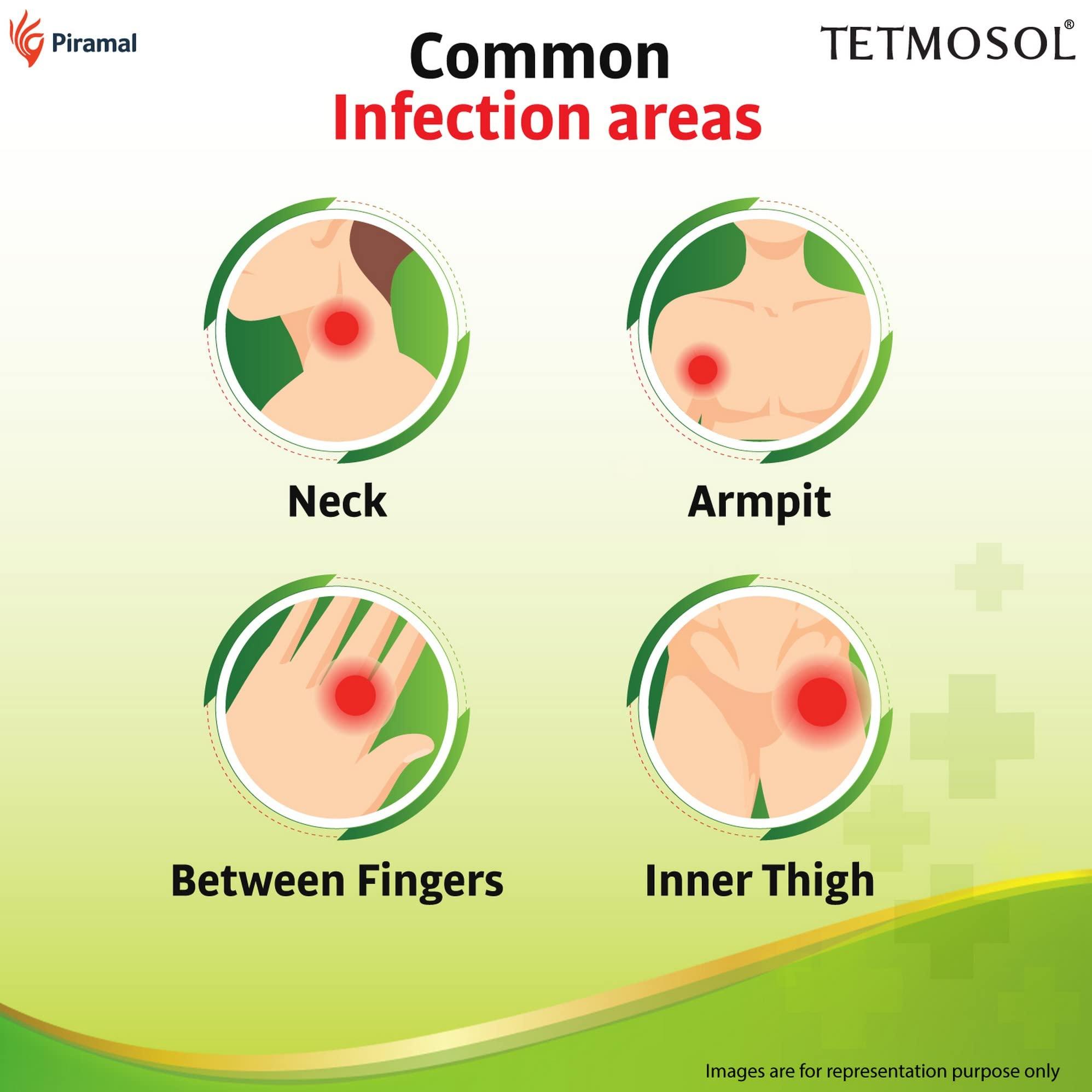 Tetmosol Plus Tetmosol Plus Cream 10 gm