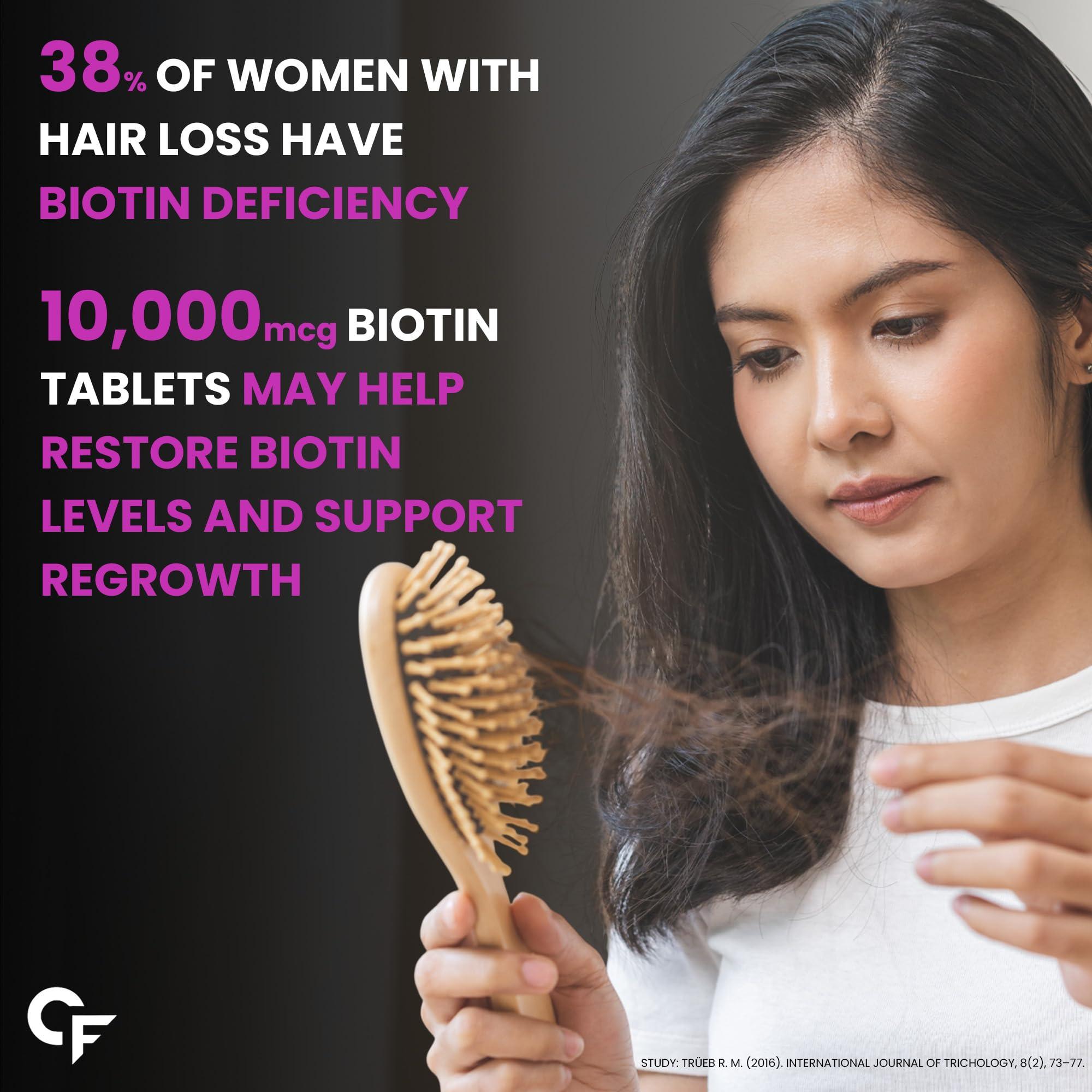 Carbamide Forte Carbamide Forte Biotin 10000mcg | Biotin Tablets for Hair Growth | Biotin Supplement for hair, skin, and nails | Hair Vitamins for Men & Women | 120 Tablets