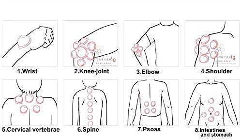 SNOFER SNOFER Plastic Therapy-Cupping Medicine Magnet Pull Out Vacuum Apparatus Therapy Relax Massagers (White) - Pack of 6