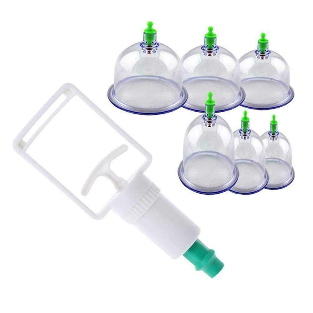 Sampton Sampton Hijama Cupping Set With Pump Vaccum Cupping Set For Pain Relief And Reduce Blood Fat Chinese Cupping Set 6 Cup Vaccum Apparatus
