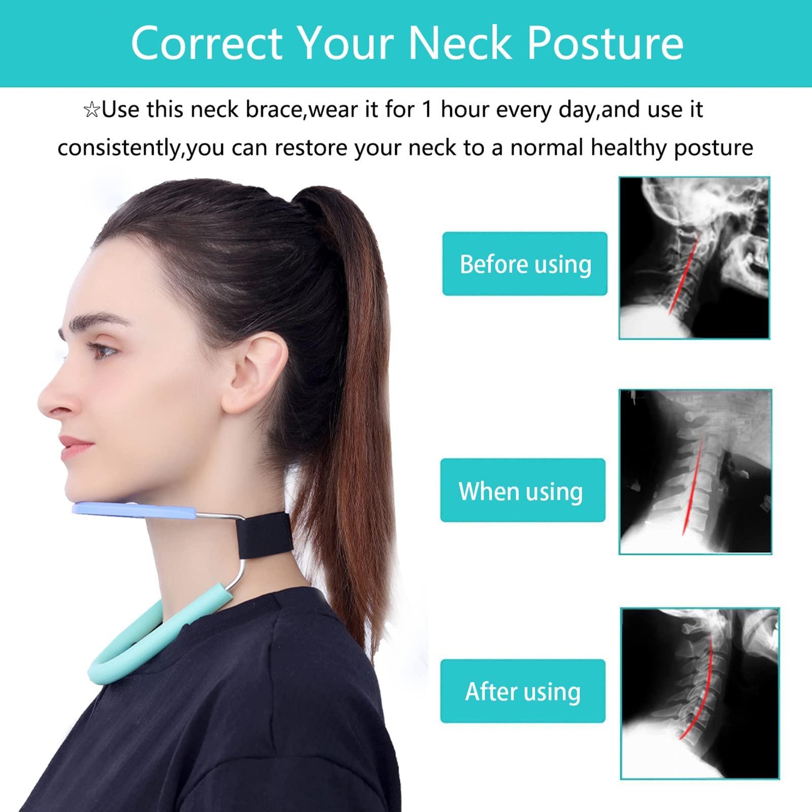 MAKINGTEC MAKINGTEC Neck Hump Corrector, Cervical Collar, Neck Brace for Neck Pain and Support, Neck alignment, Relieves Pressure in Spine, Improving Forward Head Posture