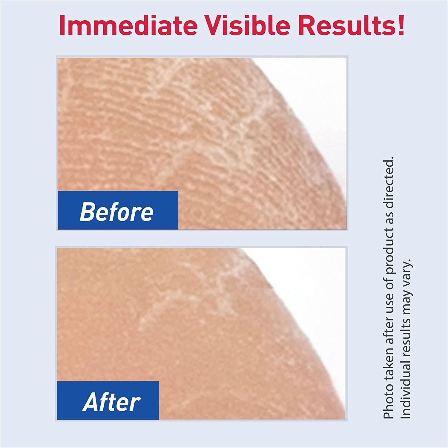 Profoot Profoot Care Heel Rescue Superior Moisturizing Foot Cream, 16 Oz