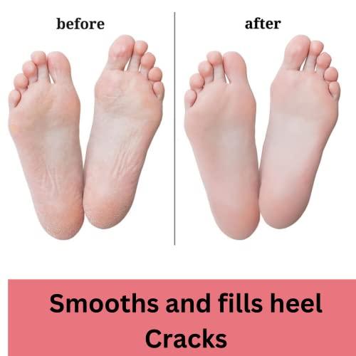 INTIMIFY INTIMIFY Foot Cream for Cracked Heels, Foot Cream For Dry Feet, Foot Crack Cream For Women & Men 50 gm (Pack of 1)