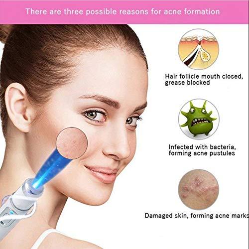 World2Home World2Home Blue Light Therapy Laser Pen Face Acne Scar Wrinkle Removal Beauty Facial Skin Care Tools