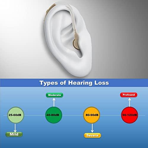 Enlinea Enlinea ENL-185 Behind-The-Ear (Bte) Hearing Aid Machine For Ear Old Age | Suitable For Mild To Moderate Hearing Loss (Pack of 1)
