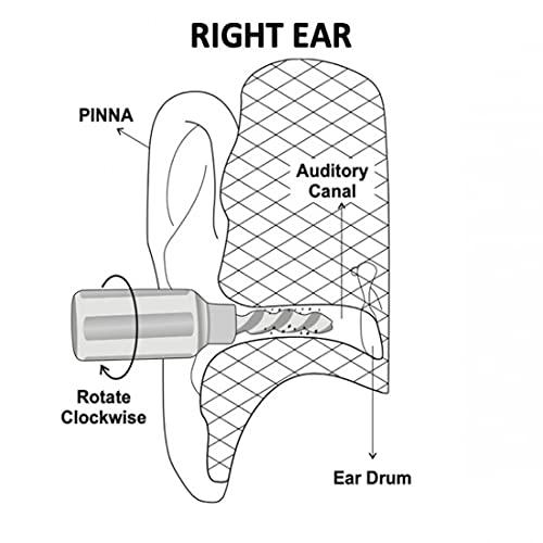 MCIPL ear’O’clean Ear Cleaner And Ear Wax Remover / Ear Scratcher (Multicolour) - Pack of 6 | Reusable ear cleaner made of very soft material to avoid injury while cleaning | Can be used as an ear-scratchin