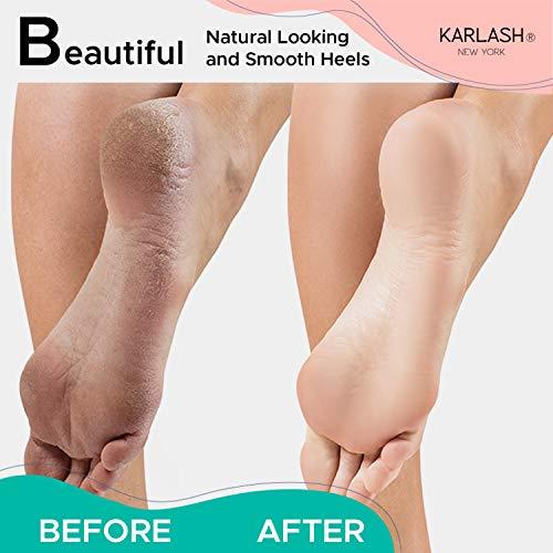 Karlash Karlash Professional Pedicure Foot Pumice Stone for Feet Skin Callus Remover and Scrubber for Dead Skins 2 Sided (Pack of 6)