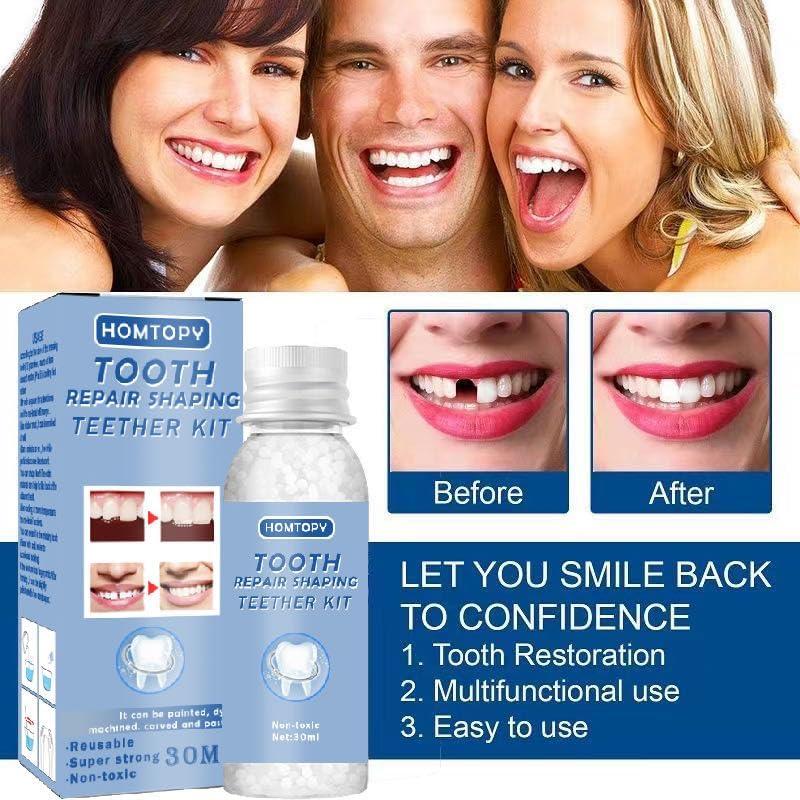 NavaFresh Basics Tooth Repair Kit, Temporary Teeth Gap Repair Kit, Temporary Teeth Replacement Kit, Tooth Repair Shaping Teether Kit