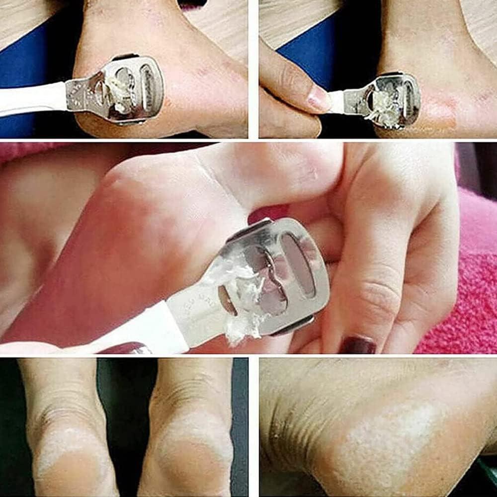 KIRA KIRA Foot Callus Shaver for Pedicure, Dead Skin Remover, Corn Cutter for Removing Solid And Cracked Skin, Heel Razor with Handle (BLUE)