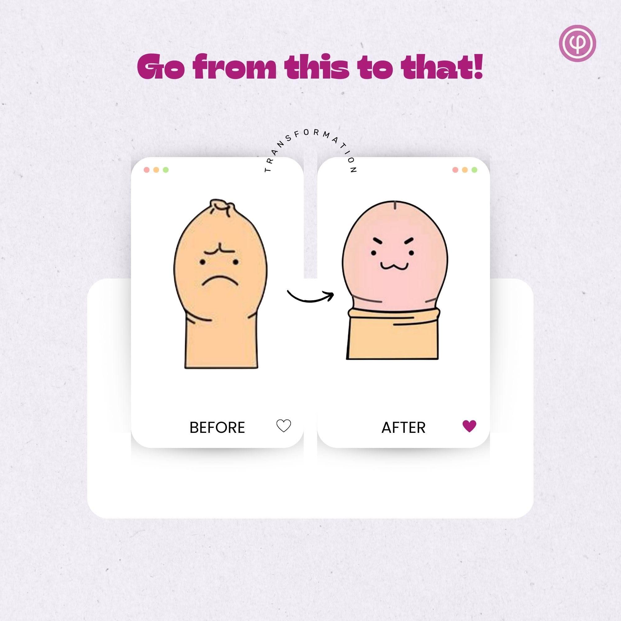 VAJRAANG Vajraang Phimosis Pro Kit with 20 x Phimosis Rings, 1 x Phimosis Cream, 1 x Phimosis oil, 1 x Track Sheet, 1 x \'How to use\' booklet | Phimosis home kit | Proven results | Medical grade silicone