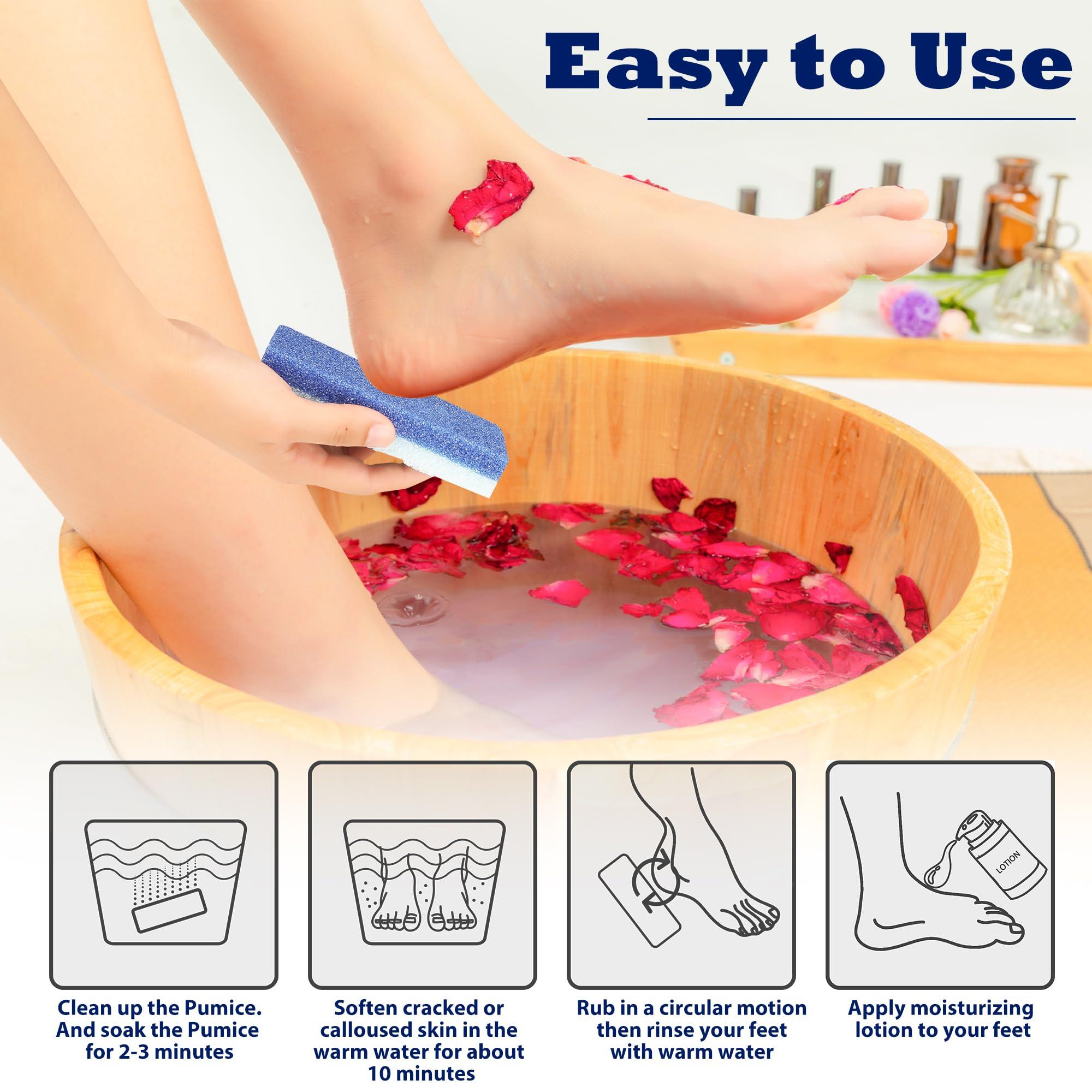 EWAGOA Foot Pumice Stone for Feet Callus Remover 6PCS Foot Pumice Foot Pumice