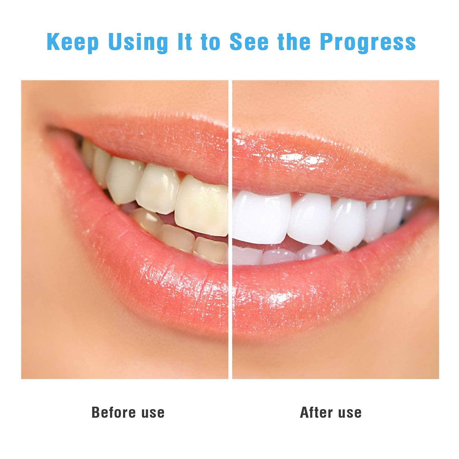 ubersweet Ubersweet® Imported Baugger 50pcs TEE-TH Wipes Oral Brush Ups Deep Cleansing Finger Tooth Wipes Fresh Breath Mint Flavor TEE-TH Whitening Strips Oral Care_182685