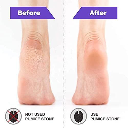 Trendy Look Trendy Look Heart Shape Pumice Stone For Removing Dead Skin/Callus/Cracked Heels For Men And Women (Small Size)
