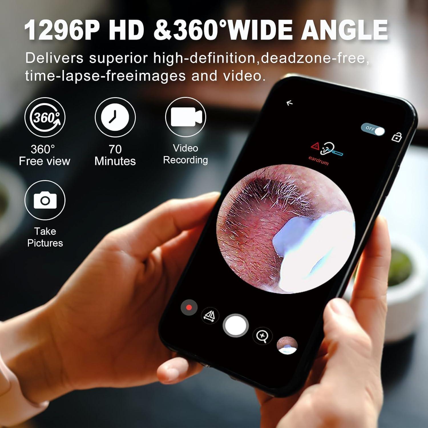 NOVUSOL NOVUSOL Ear Wax Removal Tool Kit, 9 Pcs Ear Otoscope Camera Wireless 1296P HD 3.5mm Ear Wax Cleaner with 6 Led Light 350mAh Ear Camera for iOS & Android, Black 1 Year Warranty