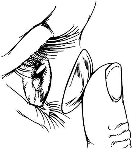 Bausch & Lomb Bausch & Lomb Soflens 59 hilafilcon B contact lenses (12 Lens Pack, -4.50)