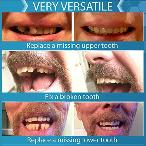 Instant Smile Instant Smile Complete Your Smile Temporary Tooth Replacment Kit - Replace a missing tooth in minutes