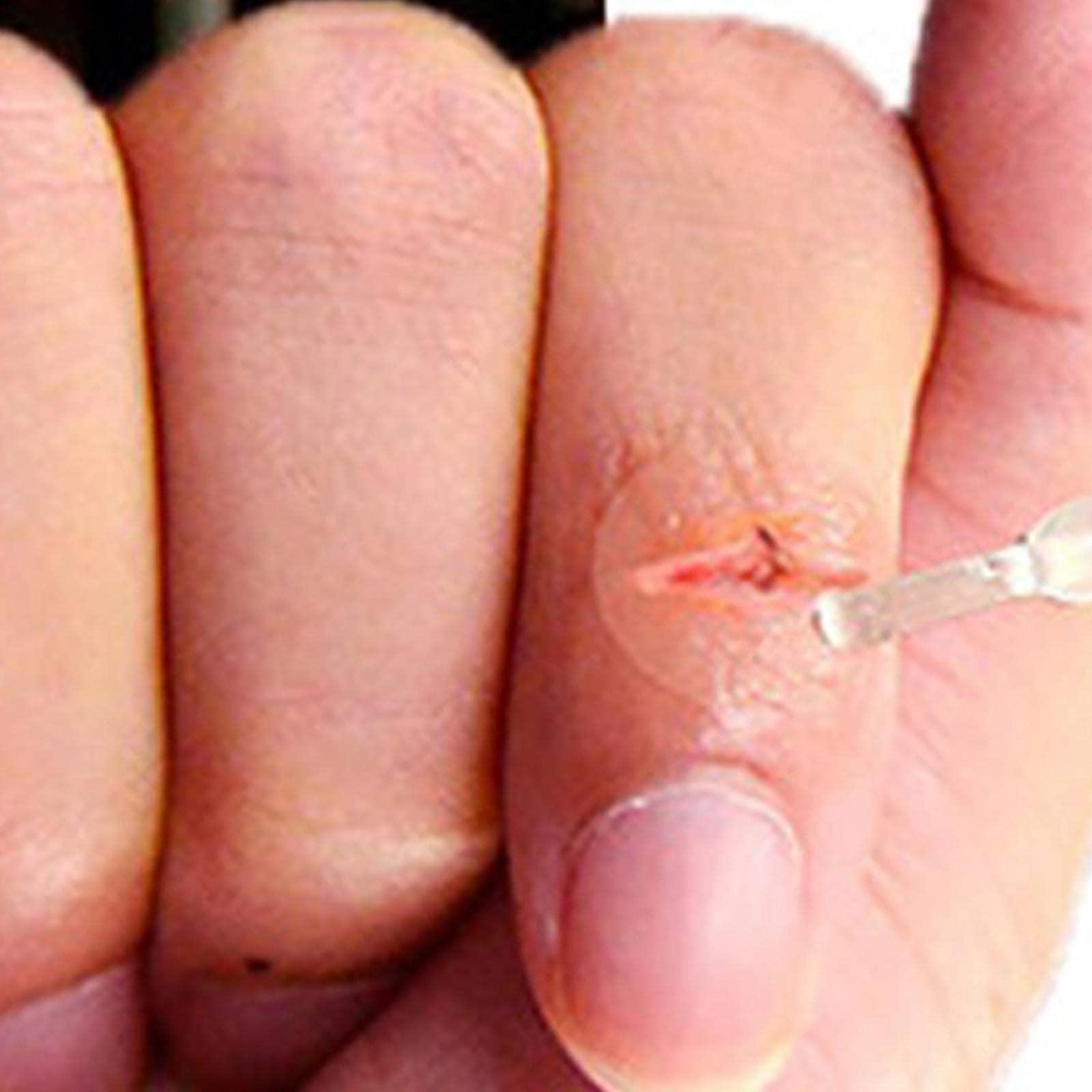 T.O.G. T.O.G. Liquid Band-Aid 10ml Rapid Film-Forming Dressing Clear for First Aid Kit