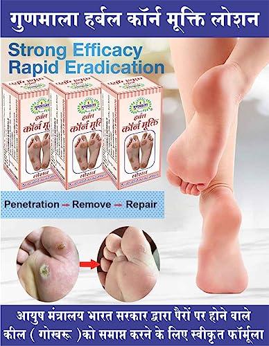 GUNMALA Herbal Foot Corn Lotion, For Remove Feet Fast And Relives From Pain & Pinch In Walking Best For Feet Infections, 5 Ml. Bottel Pack,Qty.-Pack Of 2