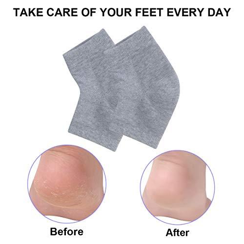 Exptolii Exptolii Vented Moisturizing Gel Heel Sock, 1 Pair Toeless Spa Sock For Foot Care Treatment, Cracked Heels, Dry Feet, Foot Calluses (Gray)