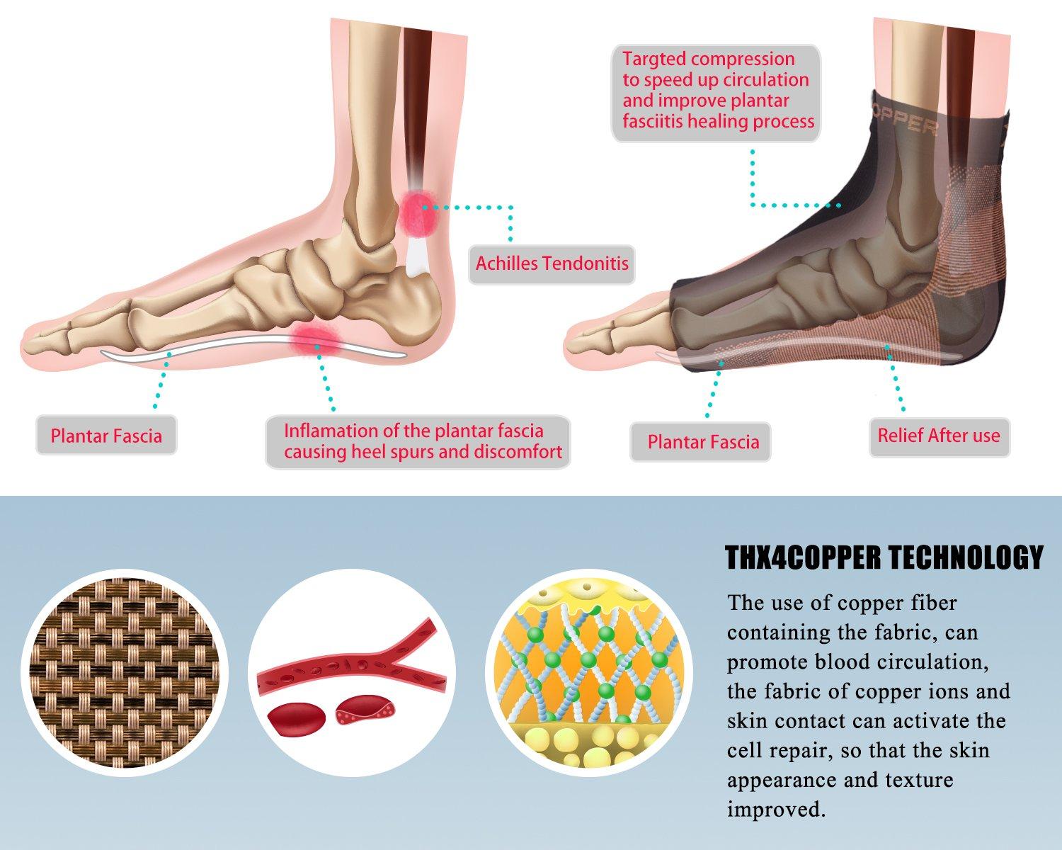 Thx4COPPER Thx4 Copper Compression Recovery Foot Sleeves for Men & Women, Copper Infused Plantar Fasciitis Socks for Arch Pain, Reduce Swelling & Heel Spurs, Ankle Sleeve with Arch Support-L/XL