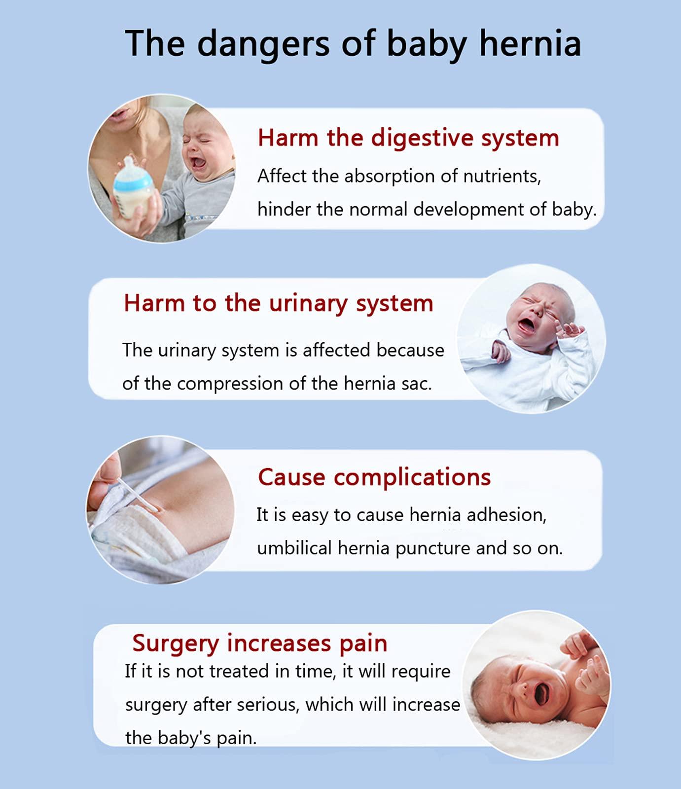 Paskyee Paskyee Umbilical Hernia Belt Baby Belly Button Band Infant Belly Wrap Abdominal Binder Hernia Truss Support Adjustable Navel Belly Band Newborn Umbilical Cord Blue