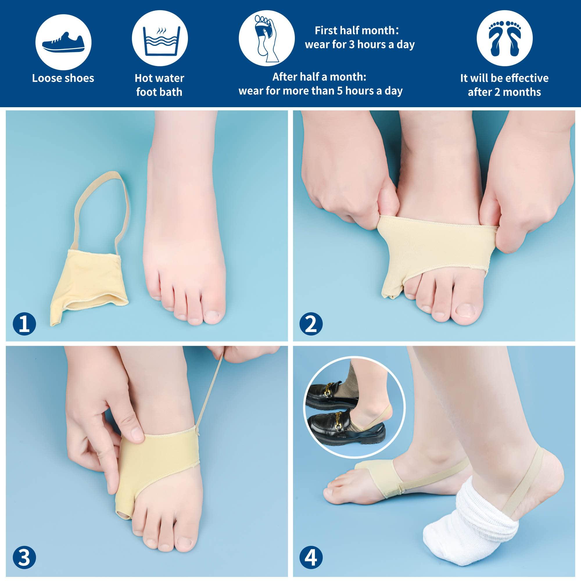 DYKOOK DYKOOK Tailors Bunion Corrector 1Pair Pinky Toe Pain Relief Bunionette Pads(Large)